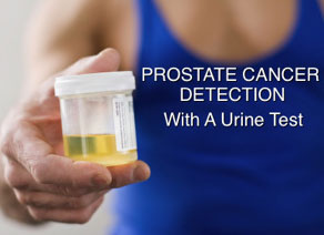 cancer-detected-by-urine-tests